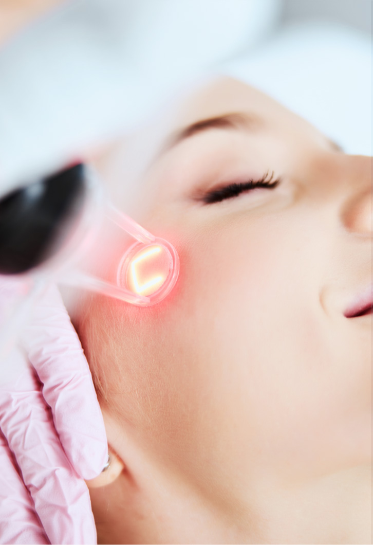 Lasers Facial Treatment
